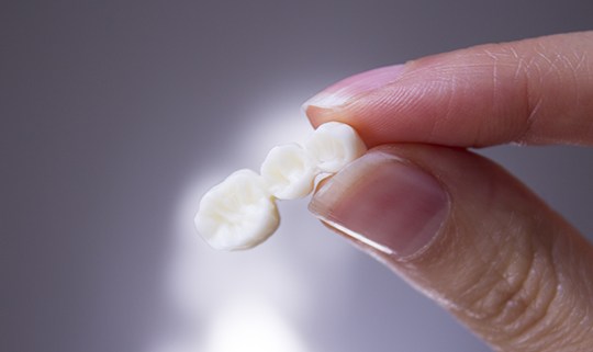 Woman holding a dental bridge