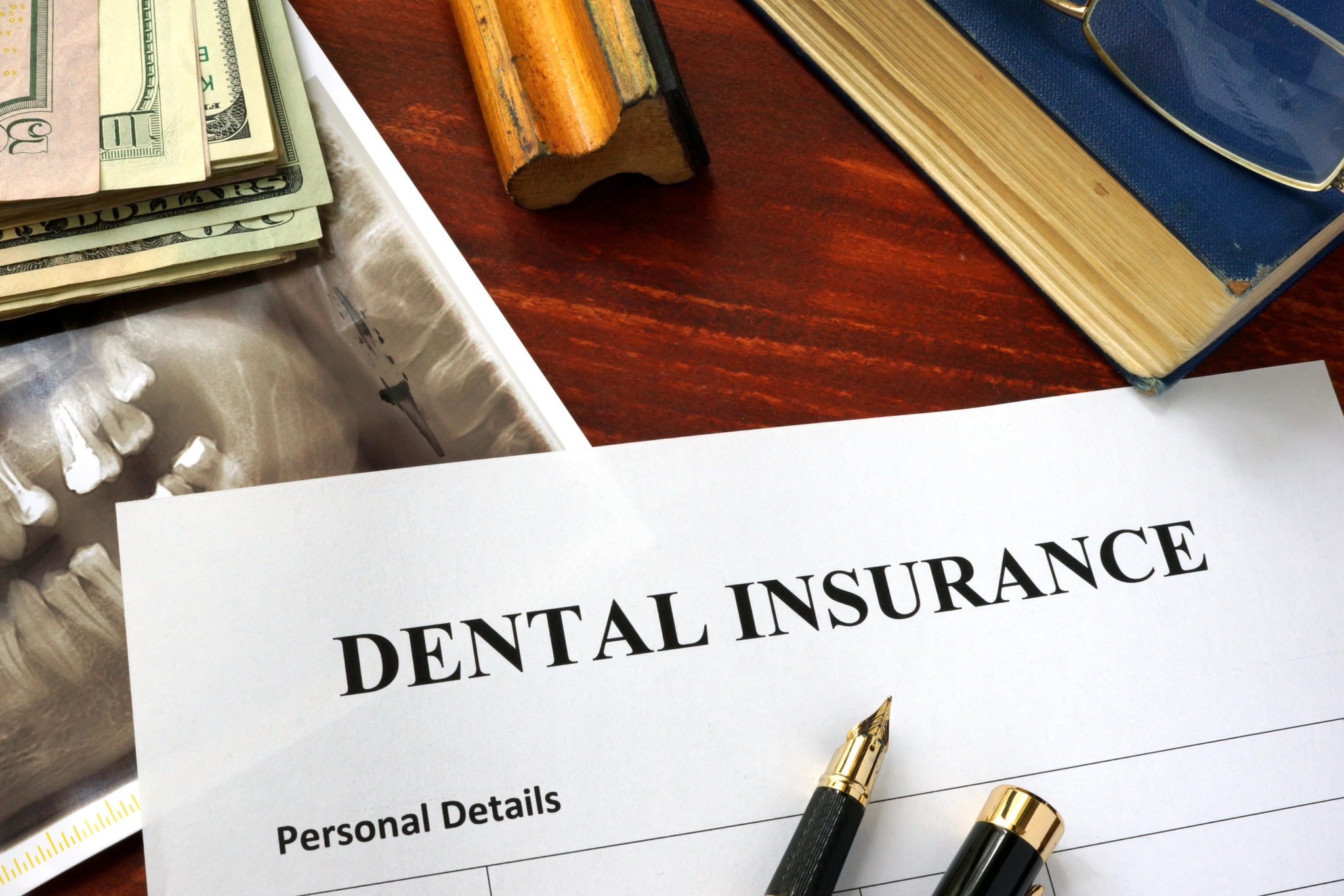 4 Helpful Tips For Understanding Your Dental Insurance